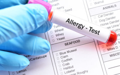 Allergia